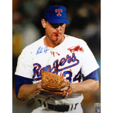 Nolan Ryan Autographed/Signed Texas Rangers 16x20 Photo Bloody Lip Beckett 51251