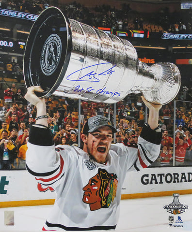 Andrew Shaw Signed Blackhawks 2013 SC Bloody Face 16x20 Photo w/Champs (SS COA)